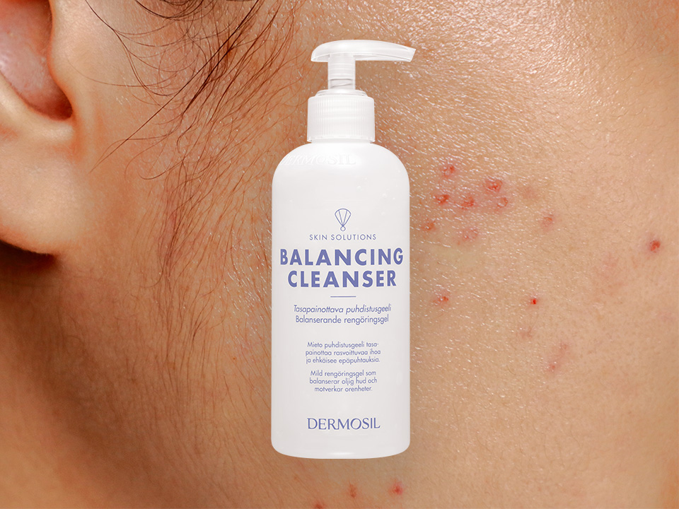 Rasuse naha puhastamine