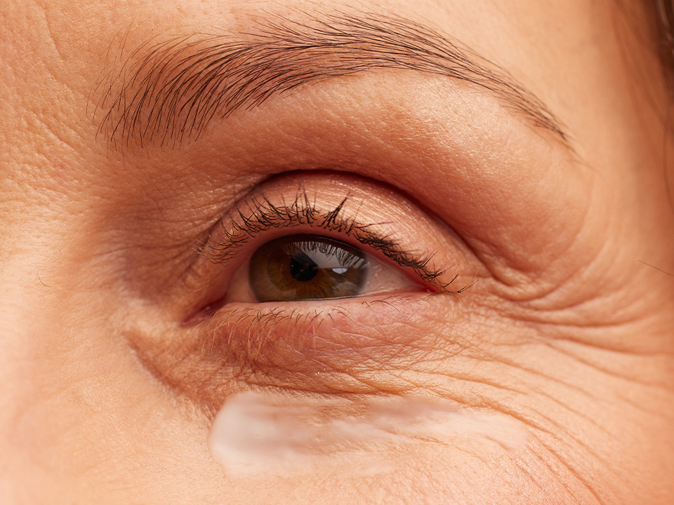 Silmaümbruskreem küpsele nahale