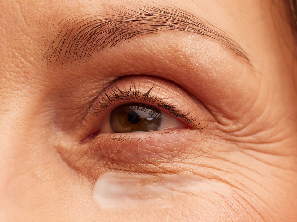 Silmaümbruskreem küpsele nahale